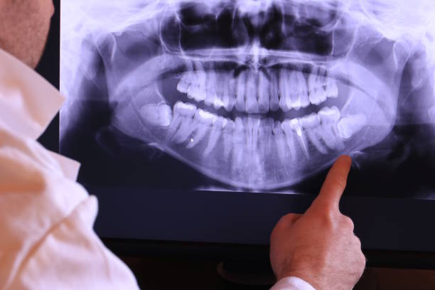 Best Emergency Treatment for Dental Infections or Abscesses in Dover, OH