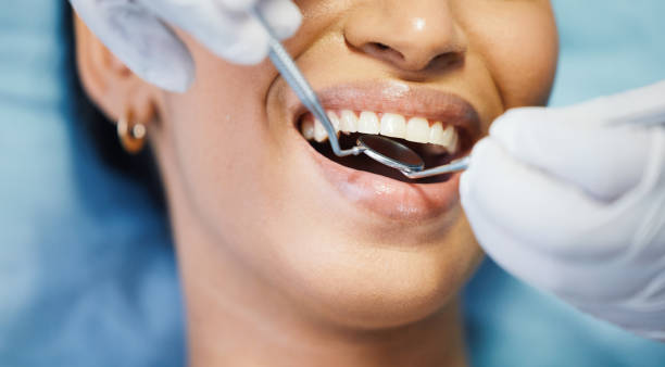 Best Emergency Dental Care for Broken or Chipped Teeth in Dover, OH